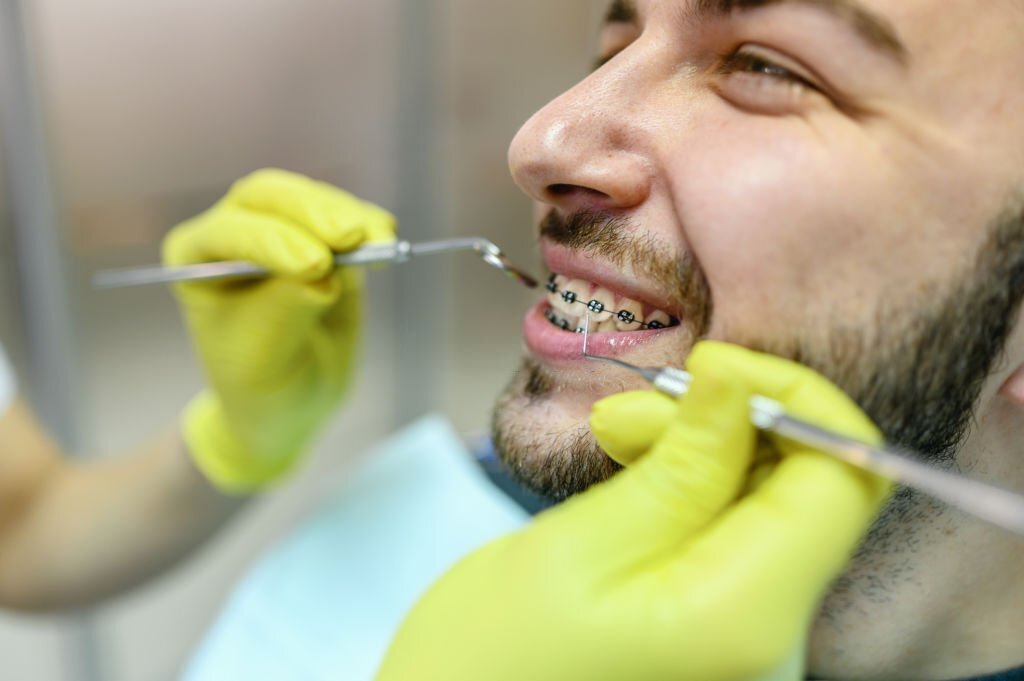 The Different Phases of Orthodontic Treatment