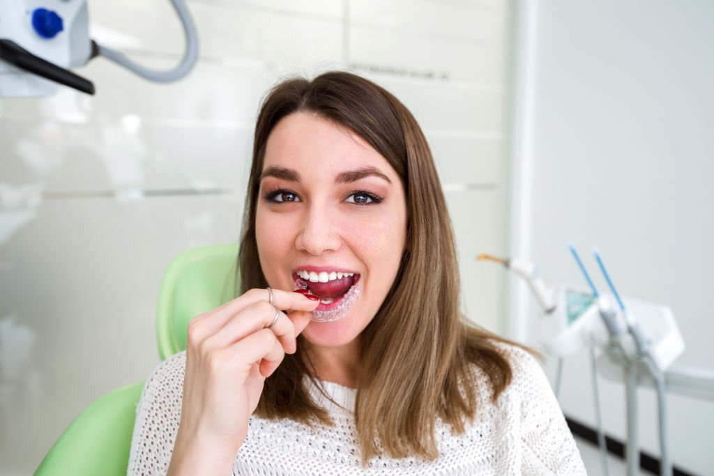 Understand the Invisalign Braces Dental Treatment Process