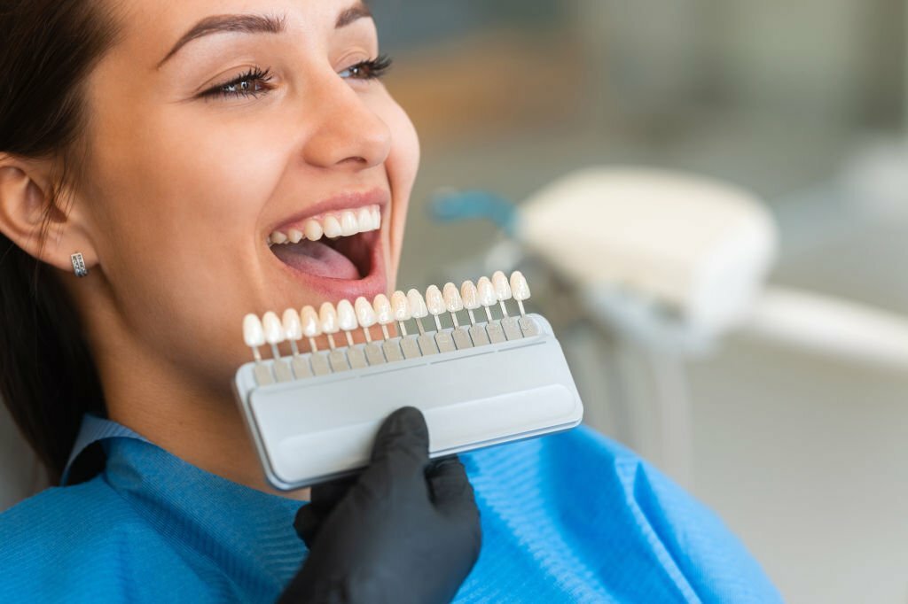 How Do Veneers Work? Do They Feel Normal?