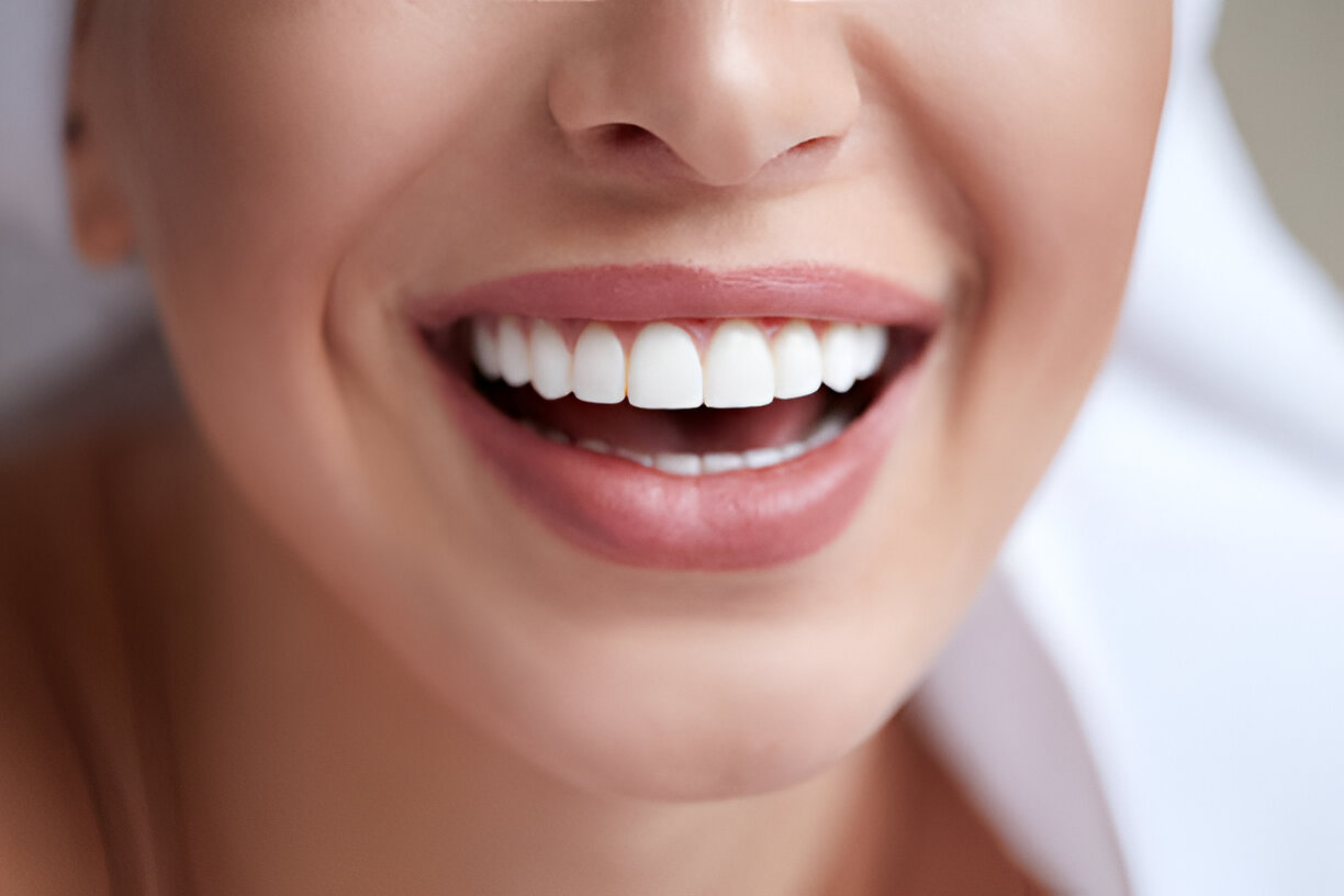 Navarro Dental Corsicana TX: Your Trusted Clinic for Teeth Whitening in Texas_FI