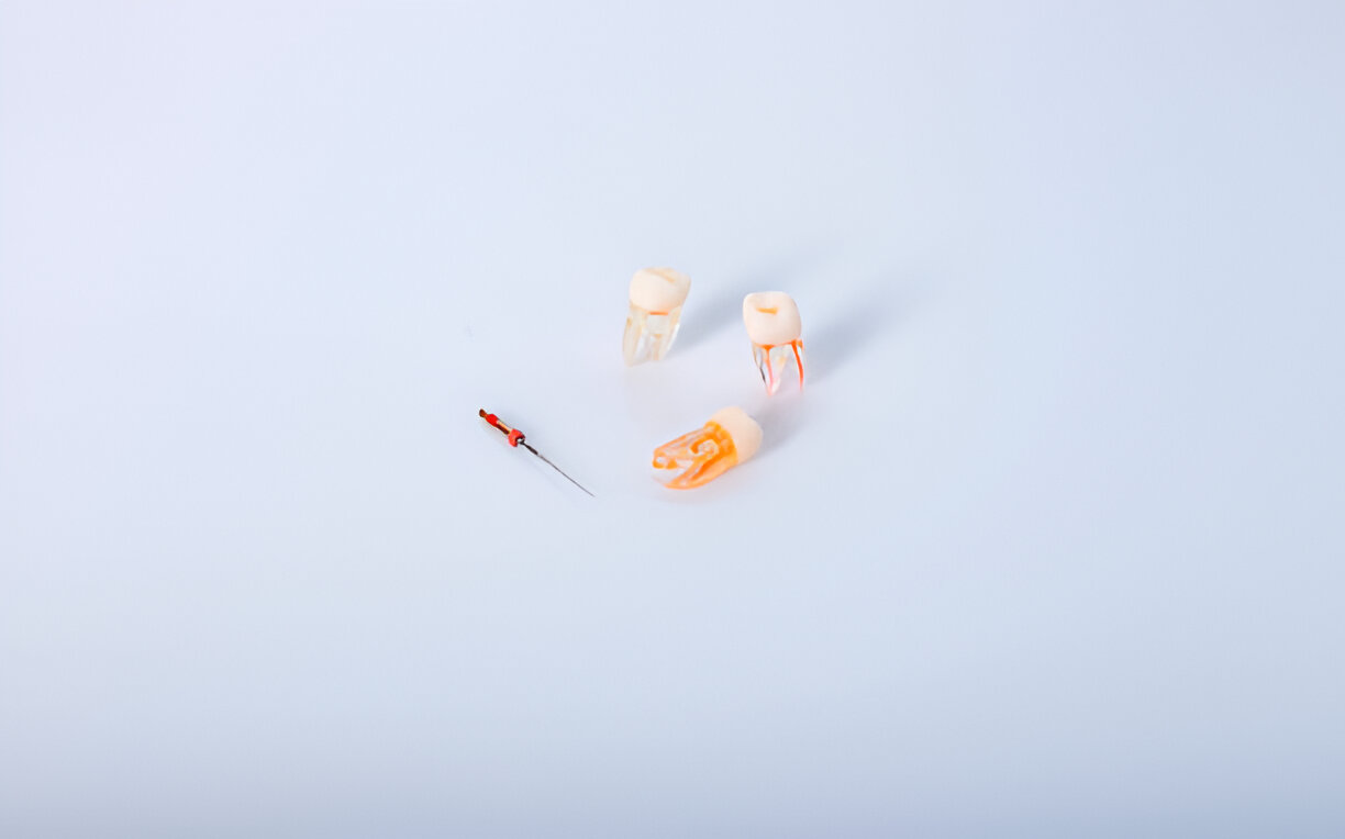 Root Canals and Beyond Comprehensive Care at Navarro Dental Corsicana Texas_FI
