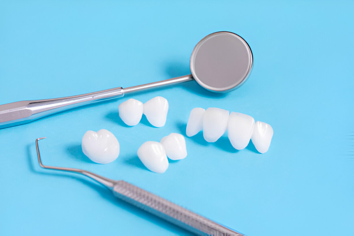 Transform Your Smile with Porcelain Crowns at Navarro Dental Center: Trusted Dentists in Corsicana, TX_FI