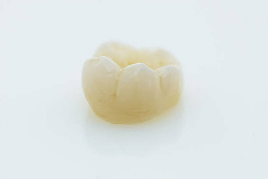 Why Navarro Dental Center Is a Trusted Choice for Tooth Replacement in Corsicana, TX_FI